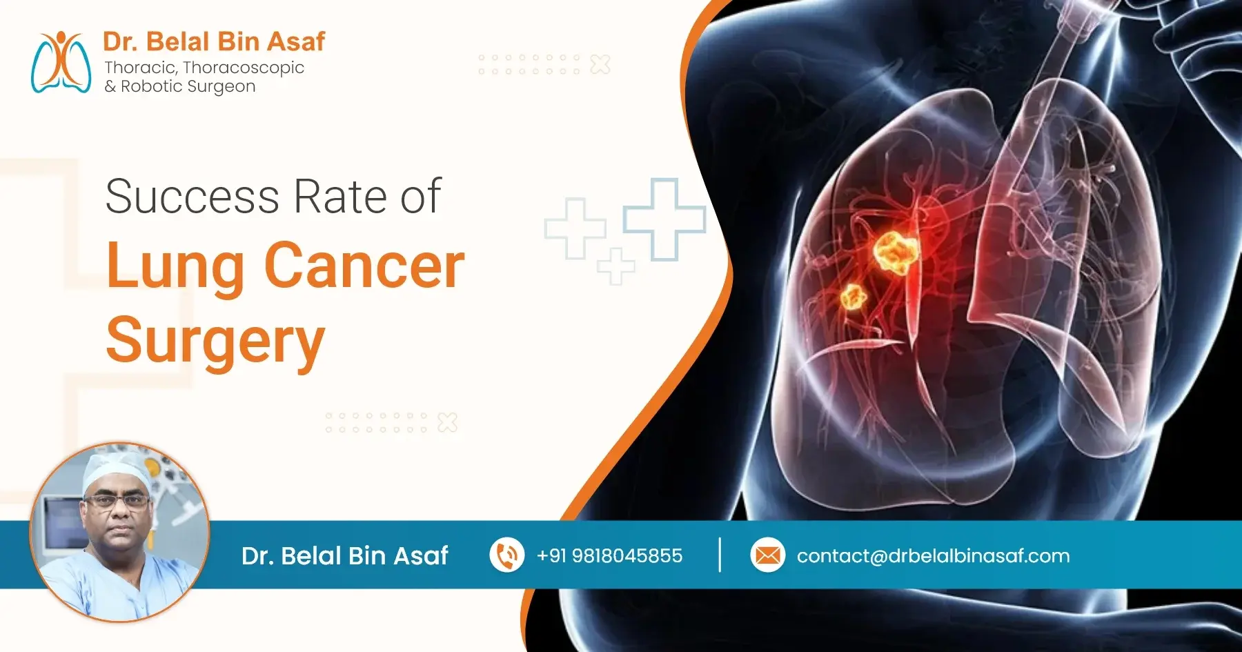 lung cancer surgery success rate