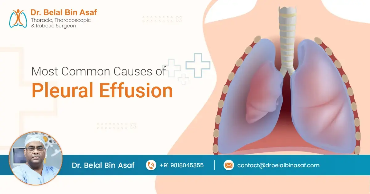 Most Common Causes of Pleural Effusion
