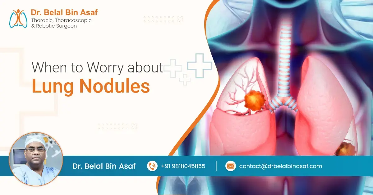 When to Worry about Lung Nodules