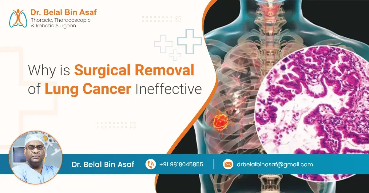Why is Surgical Removal of Lung Cancer Ineffective