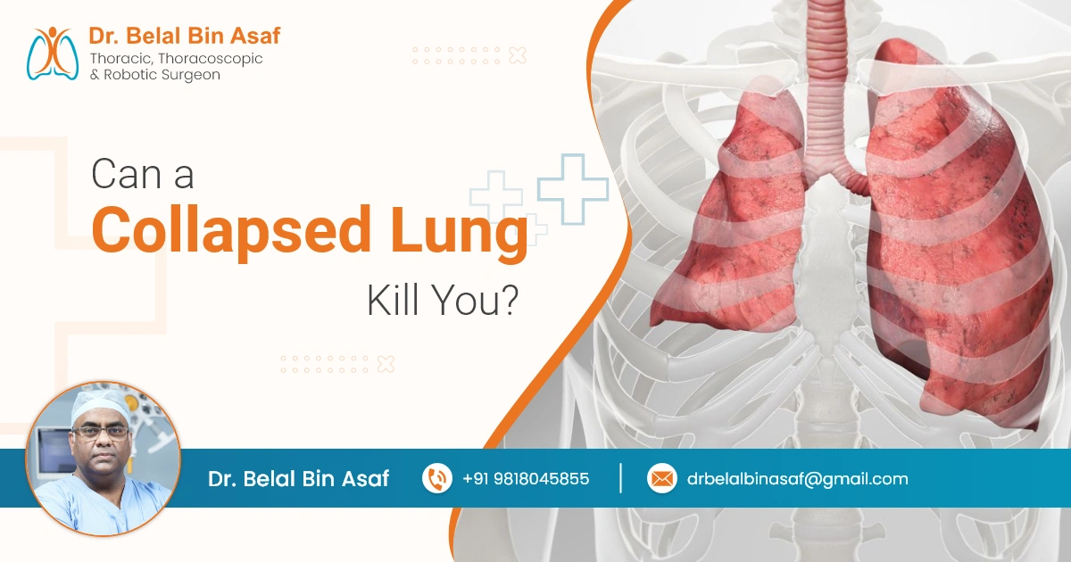 Can a Collapsed Lung Kill You? Understanding Pneumothorax and Its Risks