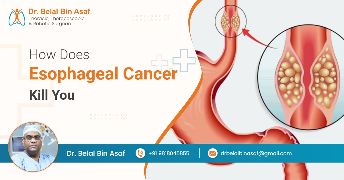 How does Esophageal Cancer Kill You