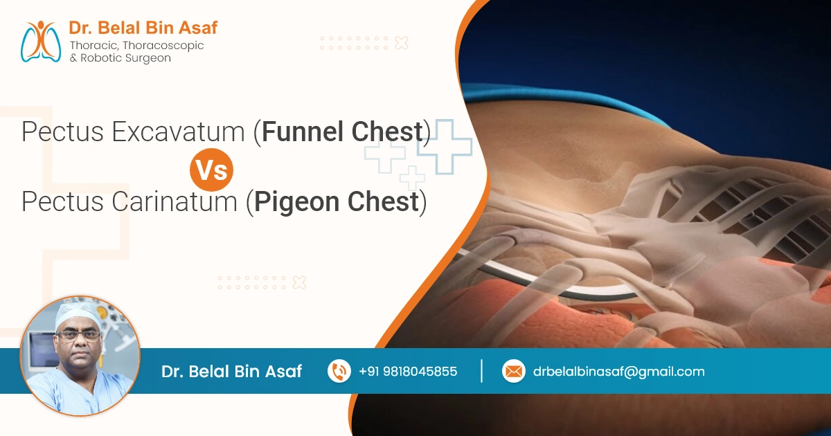 Pectus Excavatum (Funnel Chest) vs Pectus Carinatum (Pigeon Chest)