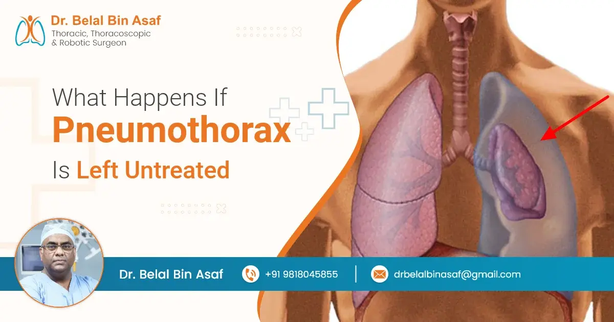 What Happens if Pneumothorax is Left Untreated