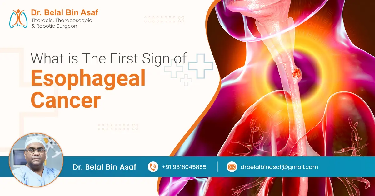 what is the first sign of esophageal cancer