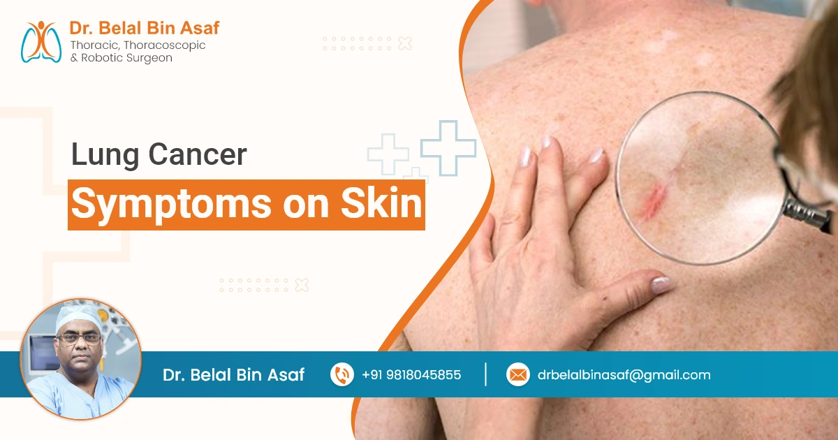 Lung Cancer Symptoms on Skin