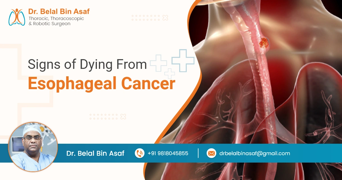 Signs of Dying from Esophageal Cancer