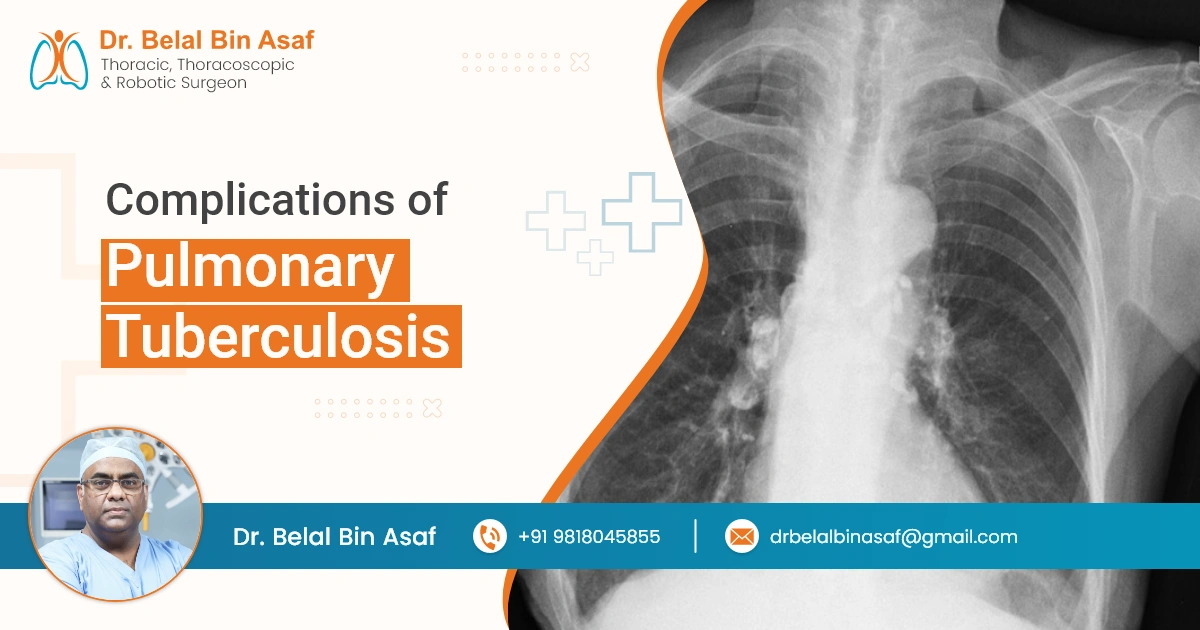 Complications of Pulmonary Tuberculosis