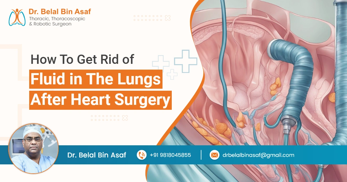 How to Get Rid of Fluid in the Lungs After Heart Surgery
