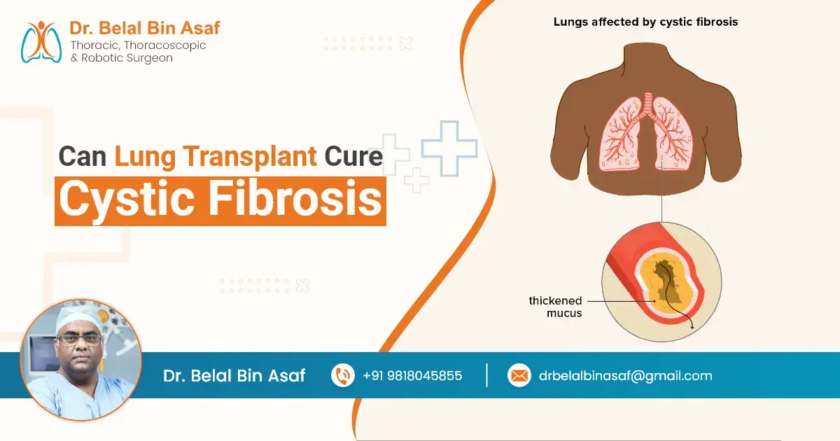 Can Lung Transplant Cure Cystic Fibrosis