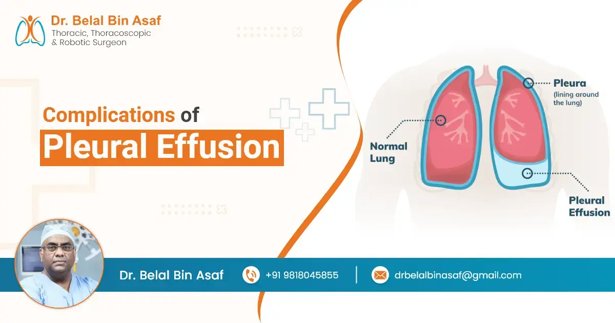 Complications of Pleural Effusion Complications of Pleural Effusion