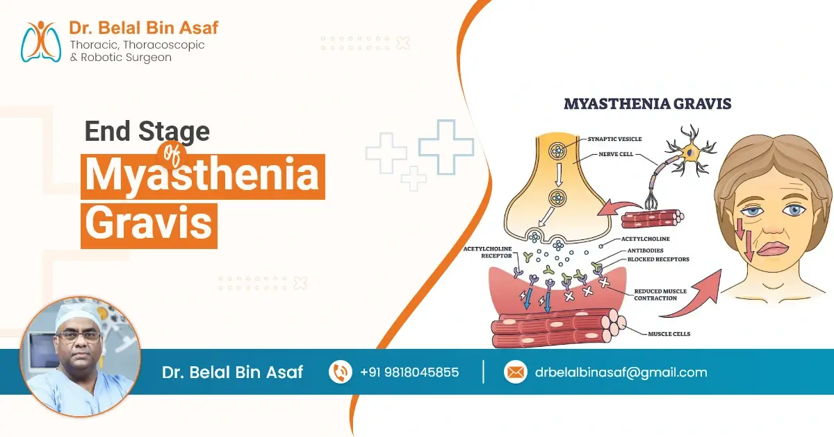 End Stage of Myasthenia Gravis
