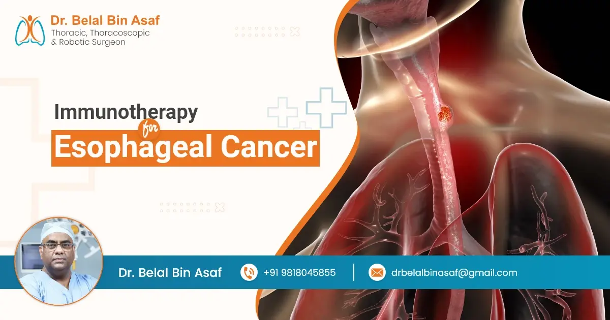 Immunotherapy for Esophageal Cancer