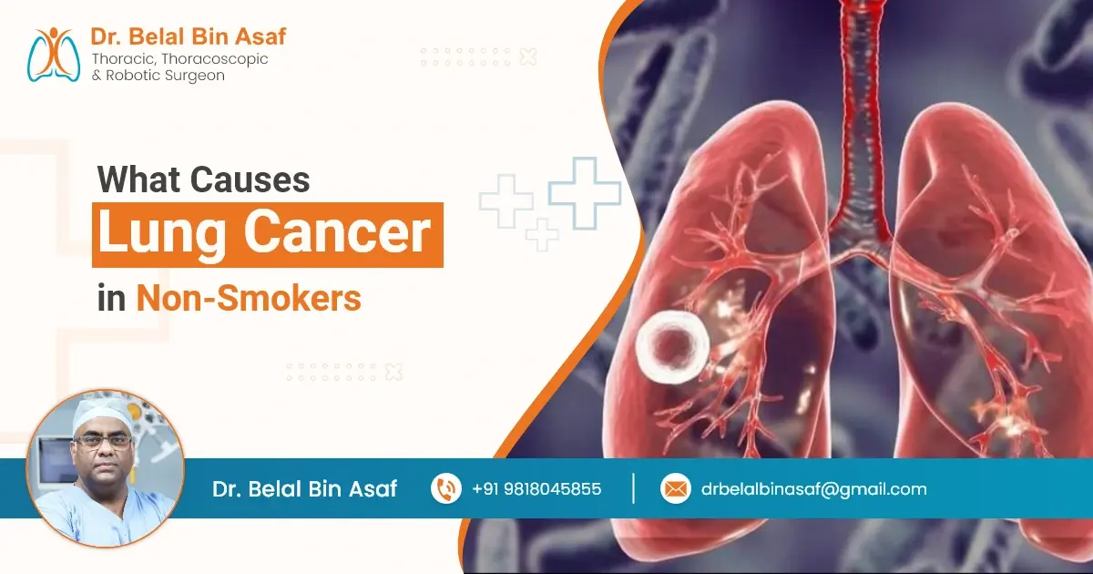 What Causes Lung Cancer in Non-Smokers