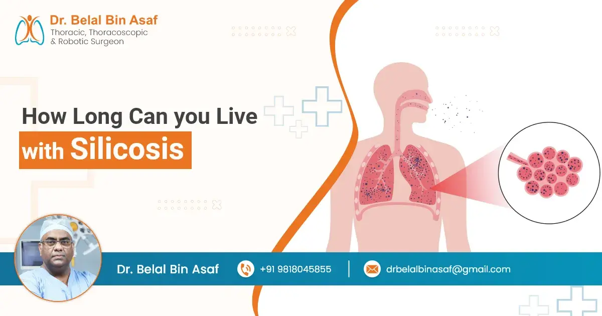 How long can you live with silicosis