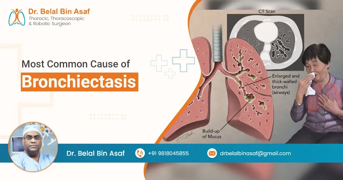 Most Common Cause of Bronchiectasis