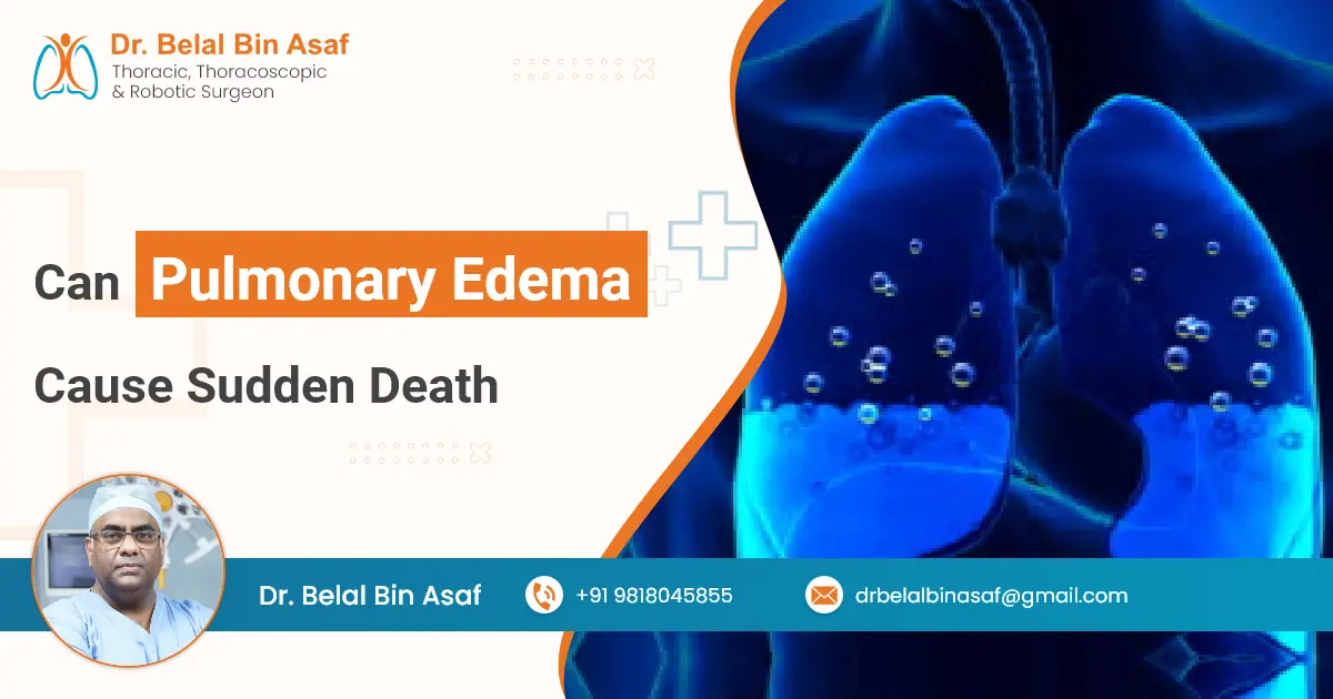 Can Pulmonary Edema Cause Sudden Death Can Pulmonary Edema Cause Sudden Death