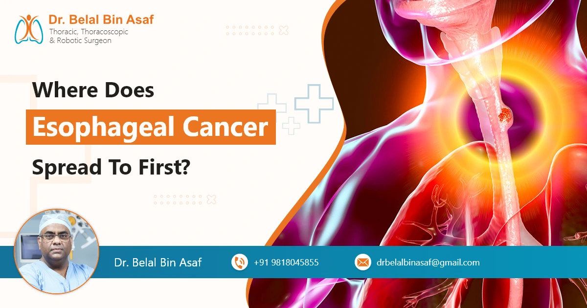 Where Does Esophageal Cancer Spread to First