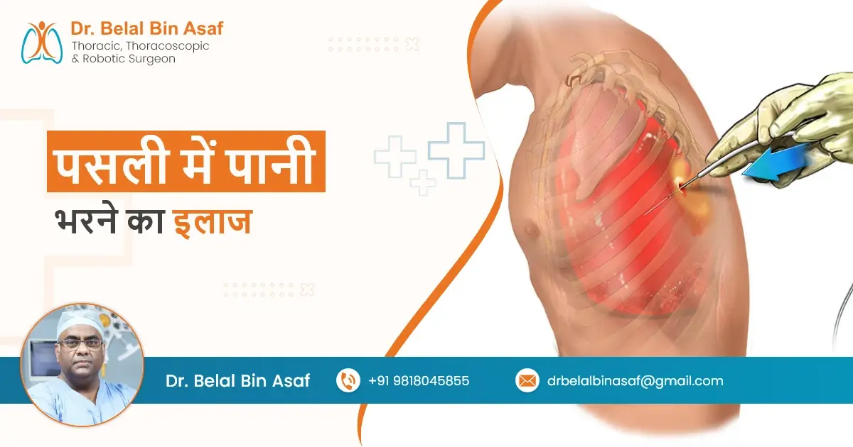 पसली में पानी भरने का इलाज