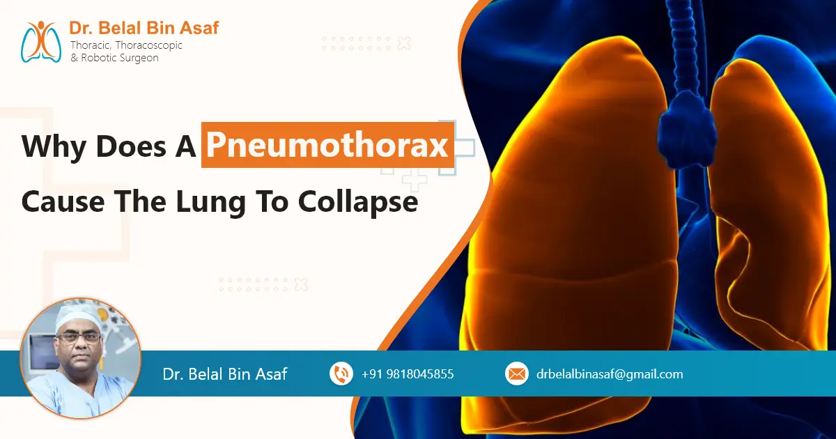 Why Does a Pneumothorax Cause the Lung to Collapse