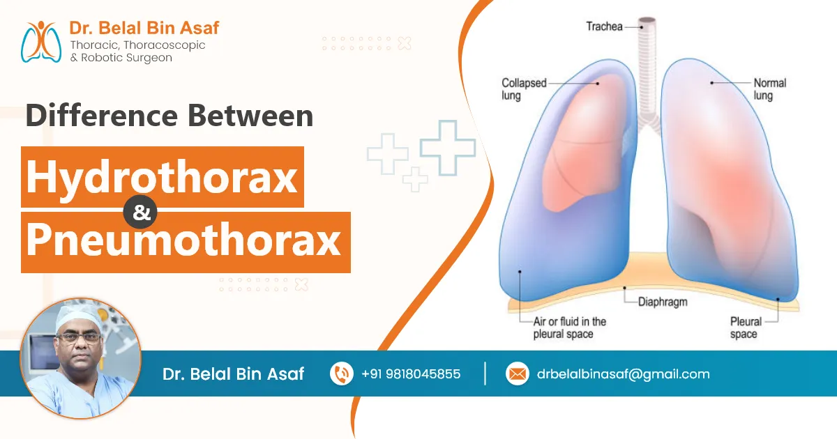 Difference Between Hydrothorax and Pneumothoraxc