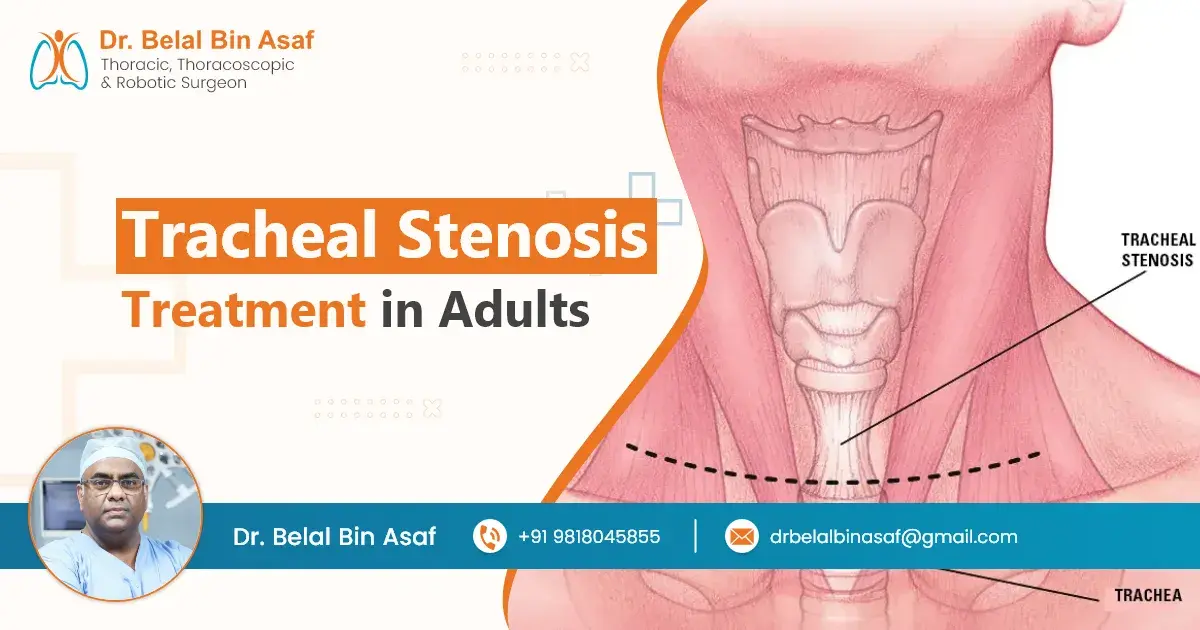 Tracheal Stenosis Treatment in Adults Tracheal Stenosis Treatment in Adults