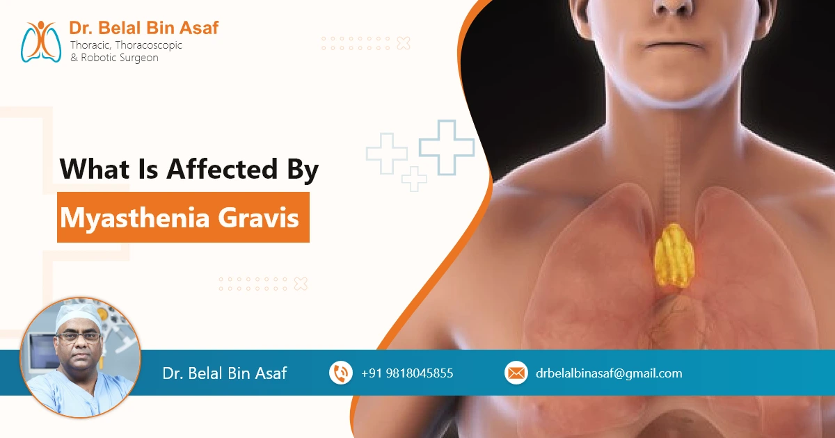 What is Affected by Myasthenia Gravis
