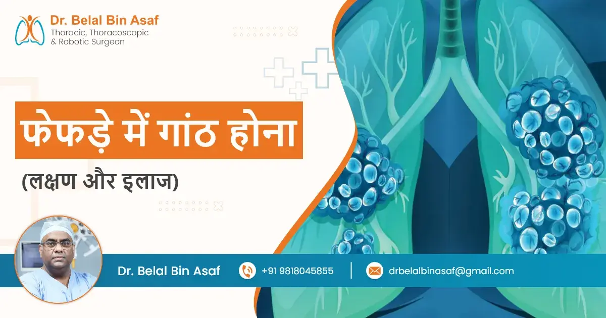 फेफड़े में गांठ होना: कारण, लक्षण और उपचार फेफड़े में गांठ होना