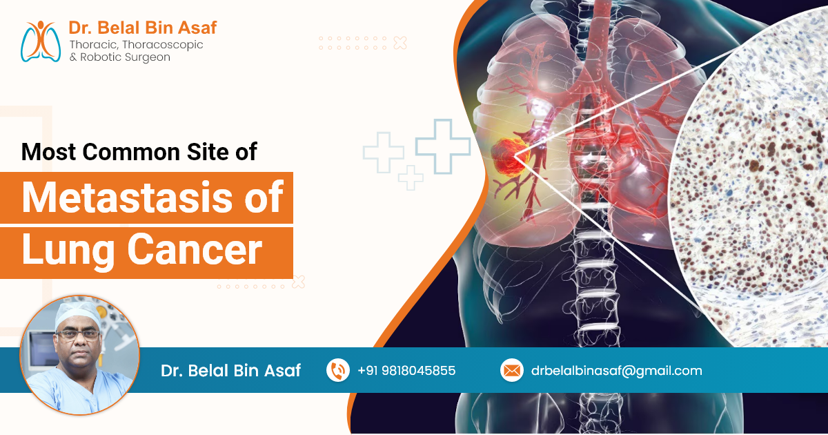 Most Common Site of Metastasis of Lung Cancer