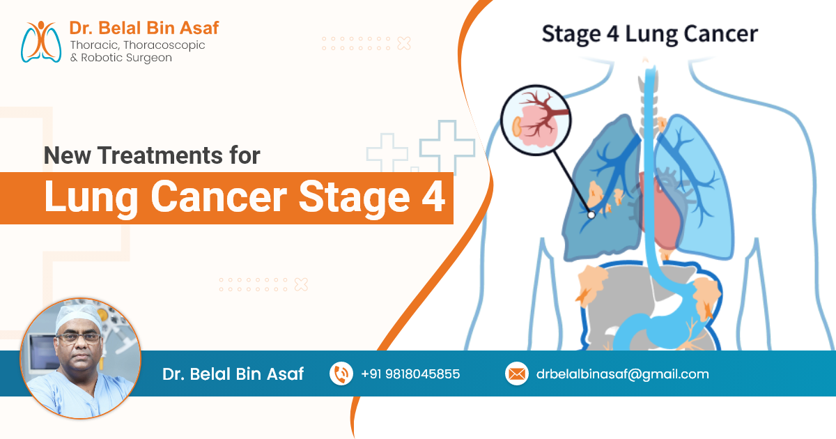 New Treatments for Lung Cancer Stage 4