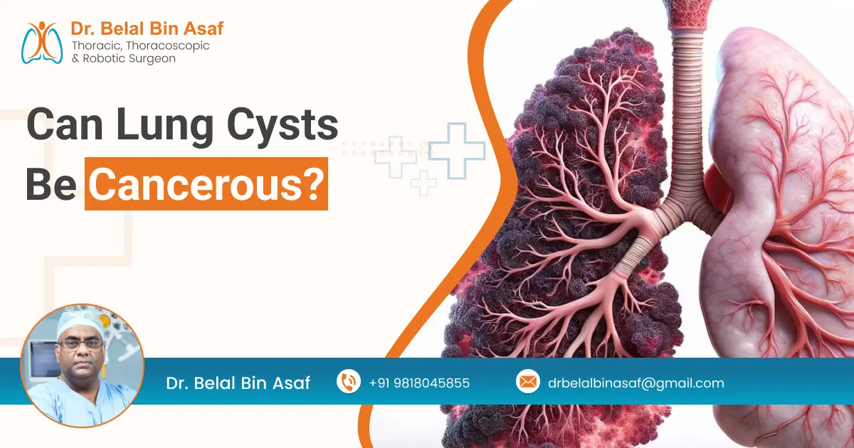 can lung cysts be cancerous_