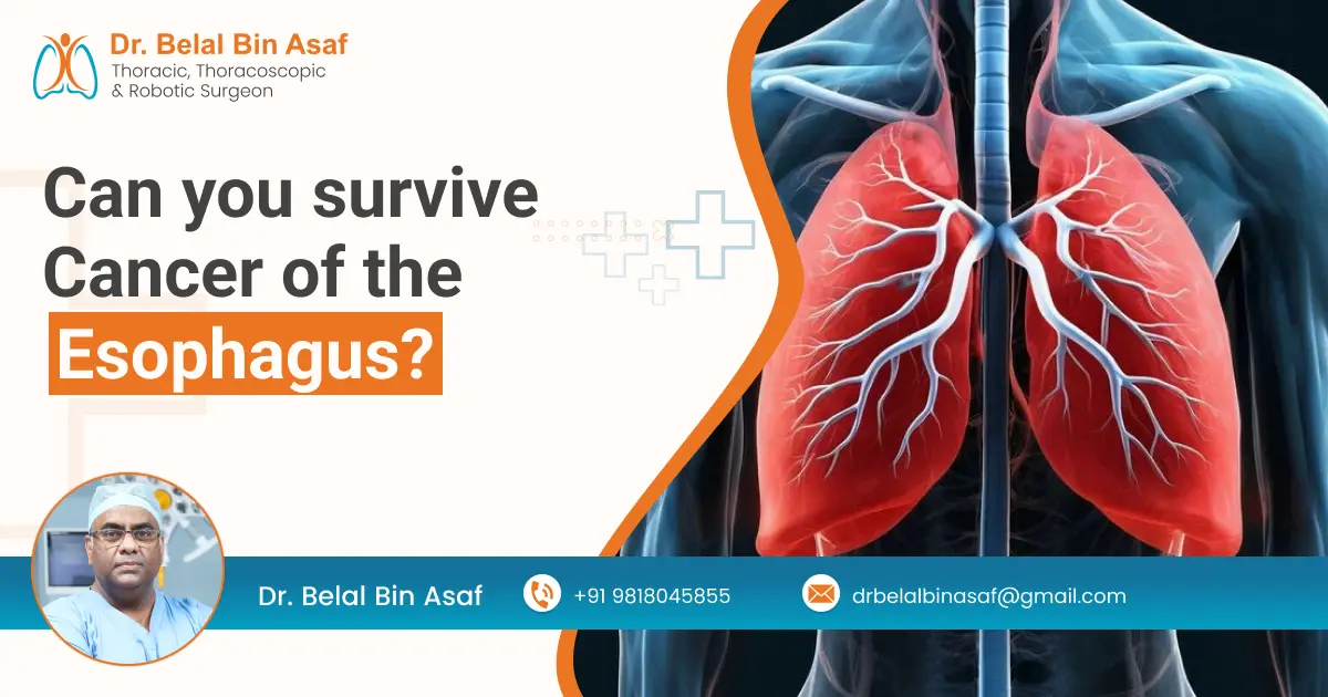 can you survive cancer of the esophagus
