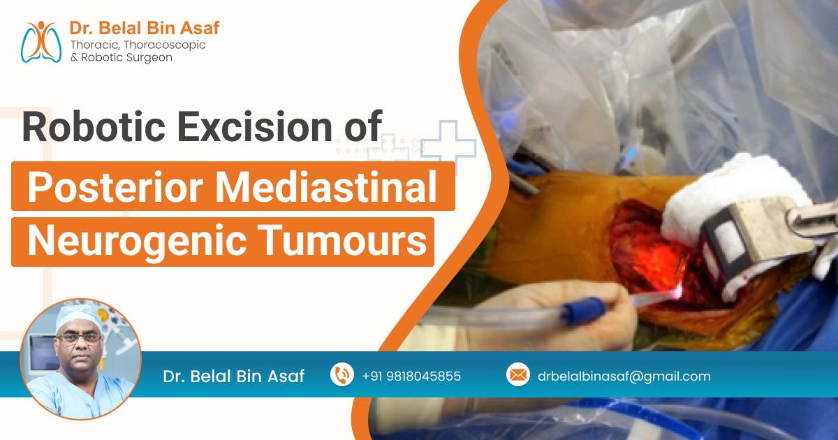 Robotic Excision of Posterior Mediastinal Neurogenic Tumours