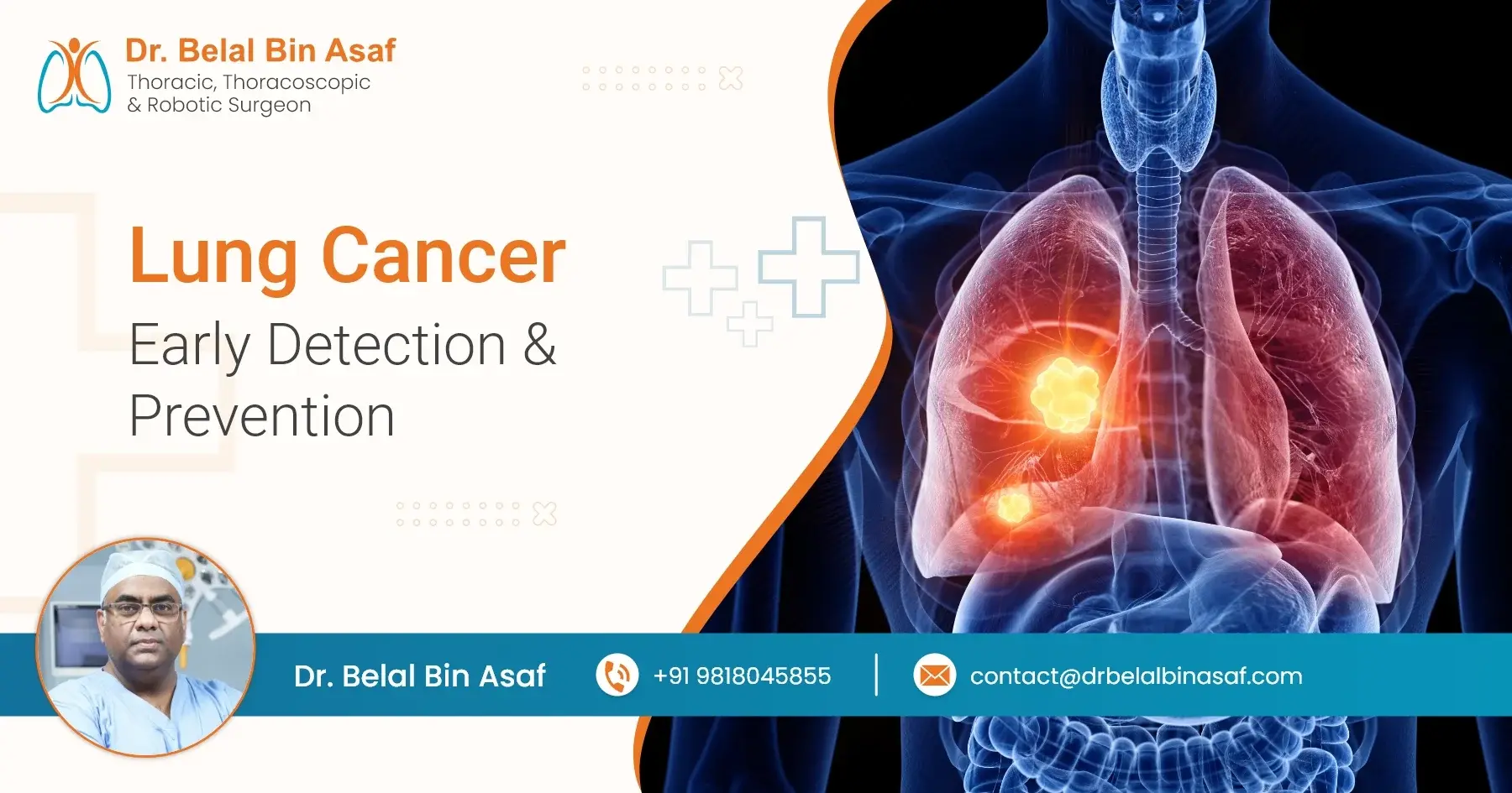 Early Detection and Prevention of Lung Cancer