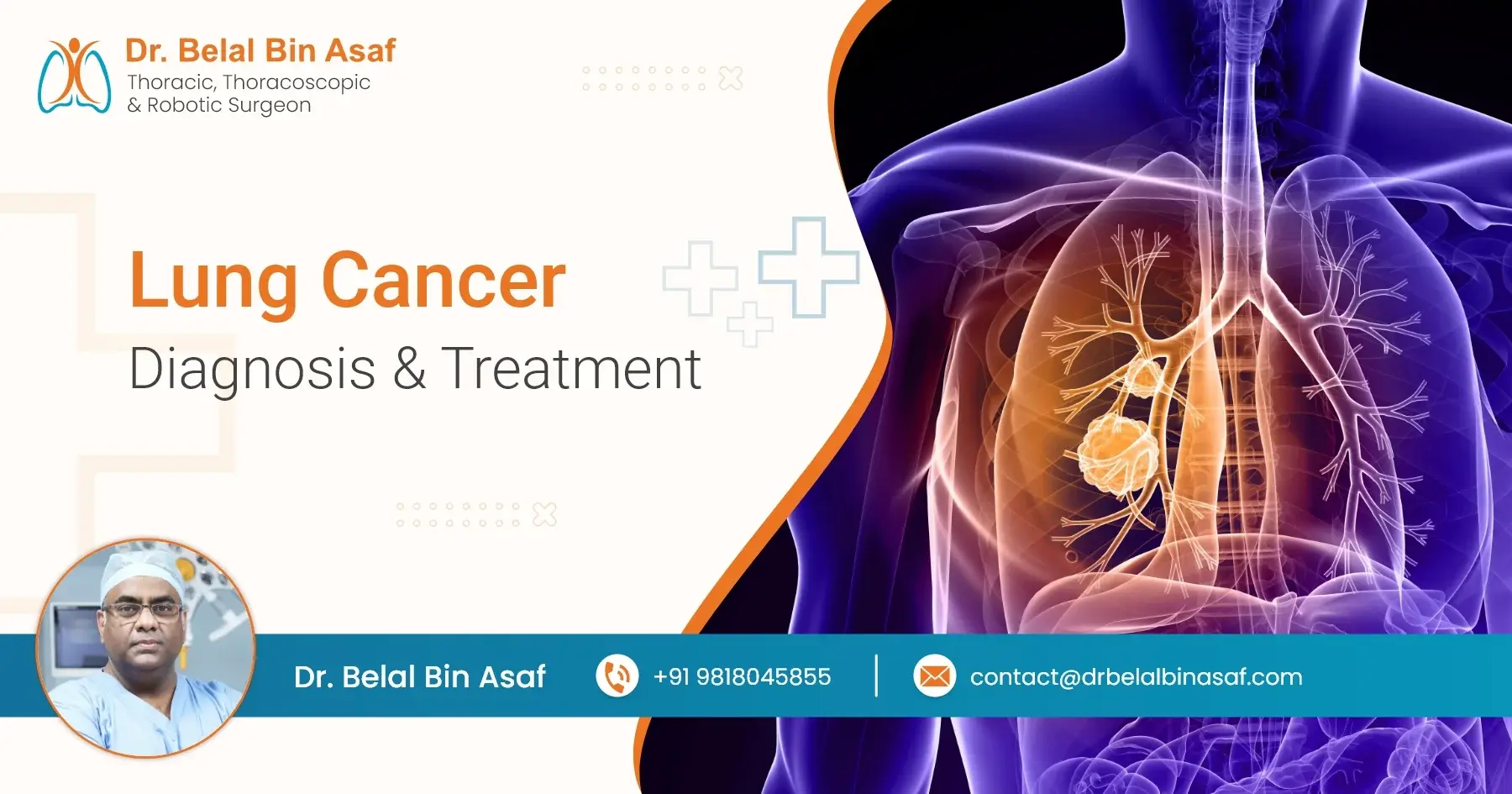 how is lung cancer diagnosed treated