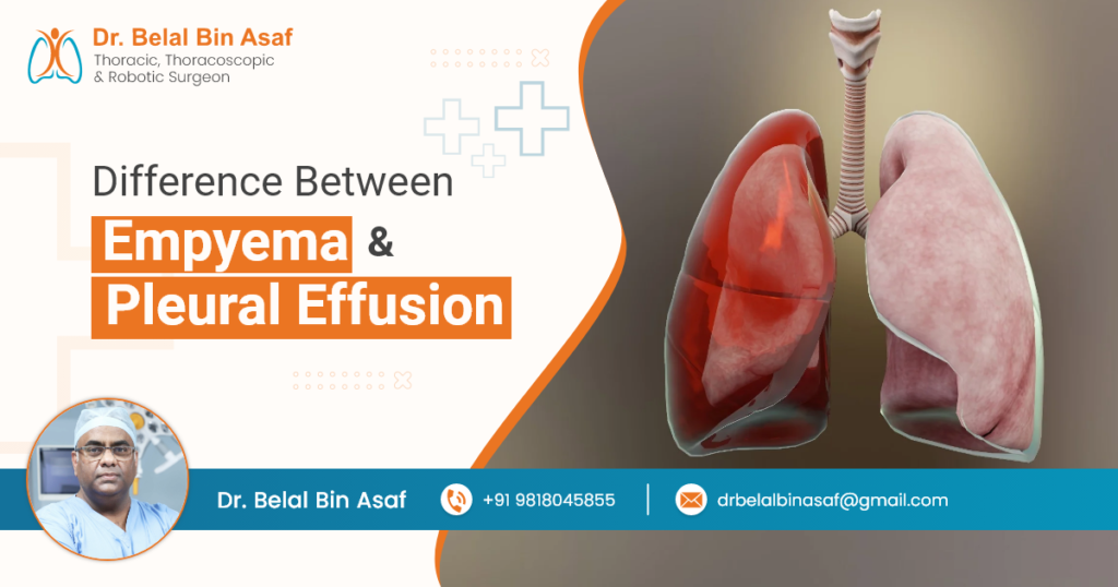 Difference Between Empyema and Pleural Effusion