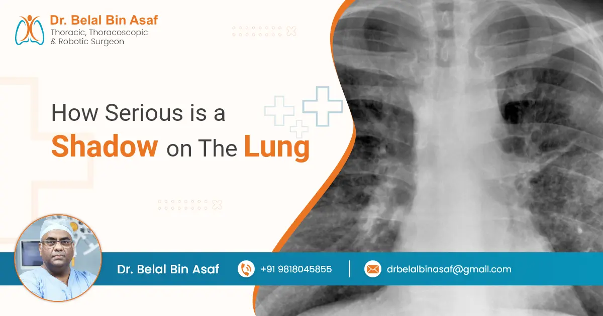 How Serious is a Shadow on the Lung? How Serious is a Shadow on the Lung?