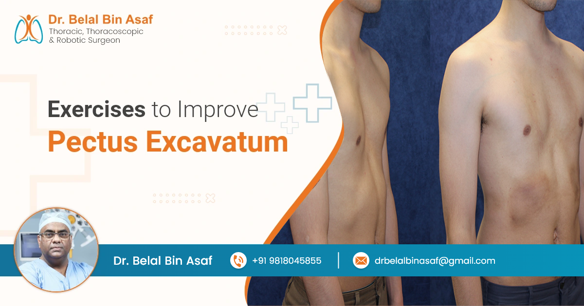 Exercises to Improve Pectus Excavatum