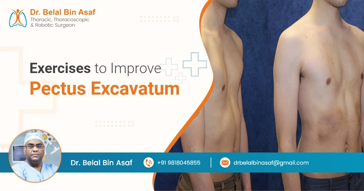 Exercises-to-improve-pectus-excavatum-2