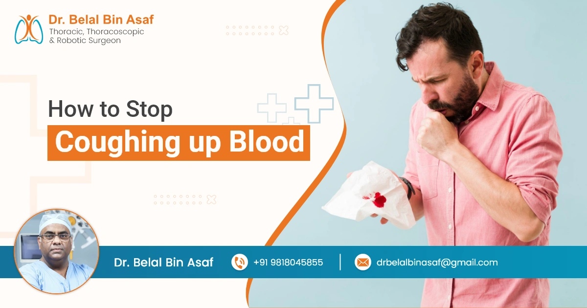 How to Stop Coughing up Blood 