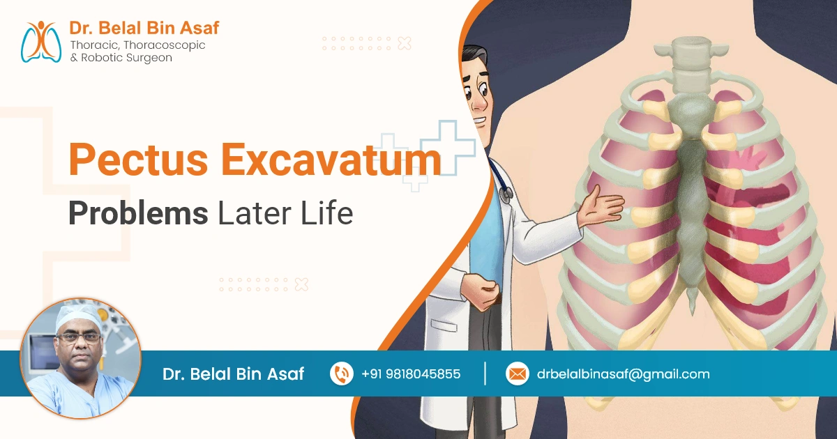 Long-Term Problems Associated with Pectus Excavatum