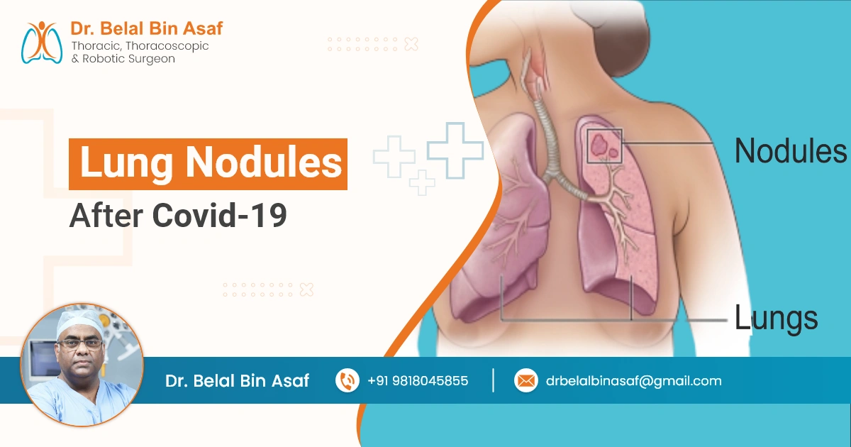 Lung Nodules After COVID-19: Understanding the Causes, Risks, and Treatment