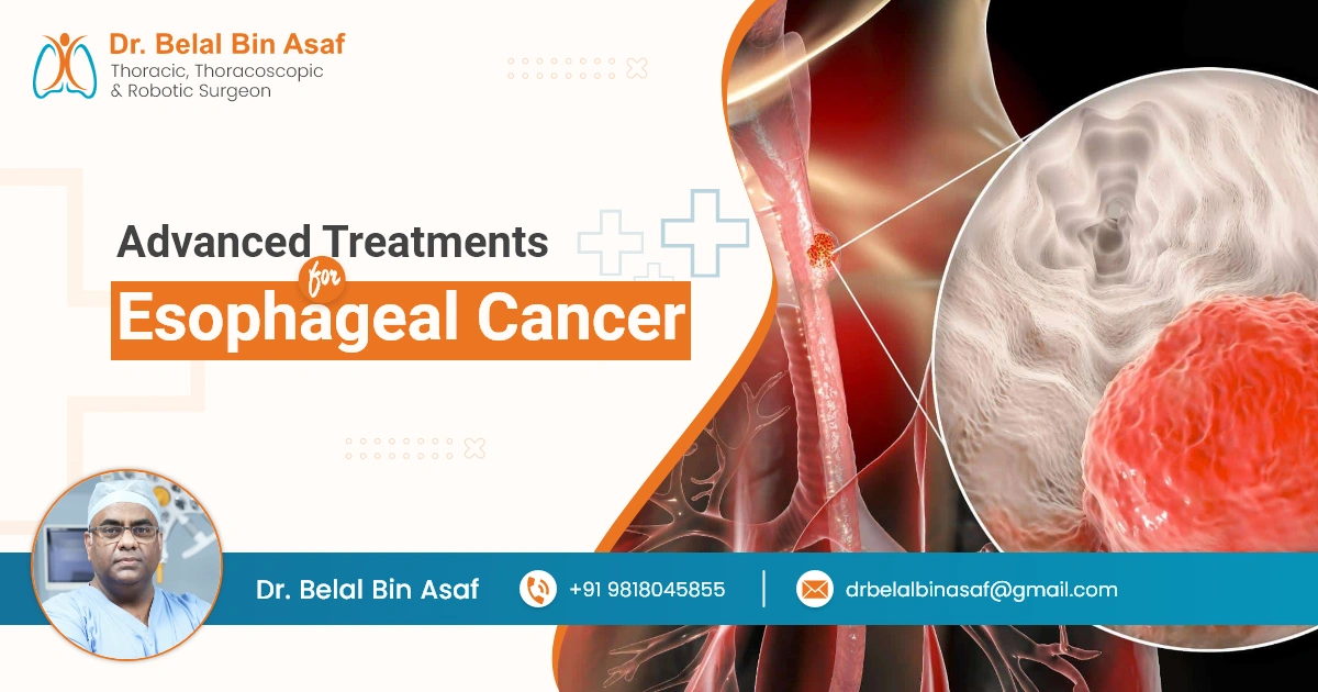 New Treatments for Esophageal Cancer: A Beacon of Hope