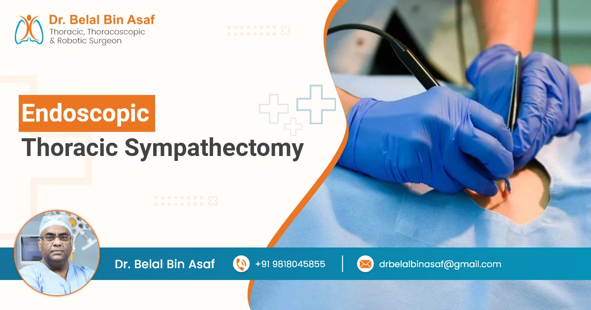 Endoscopic Thoracic Sympathectomy: A Comprehensive Overview