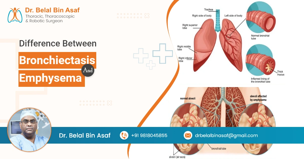 The Difference Between Bronchiectasis and Emphysema
