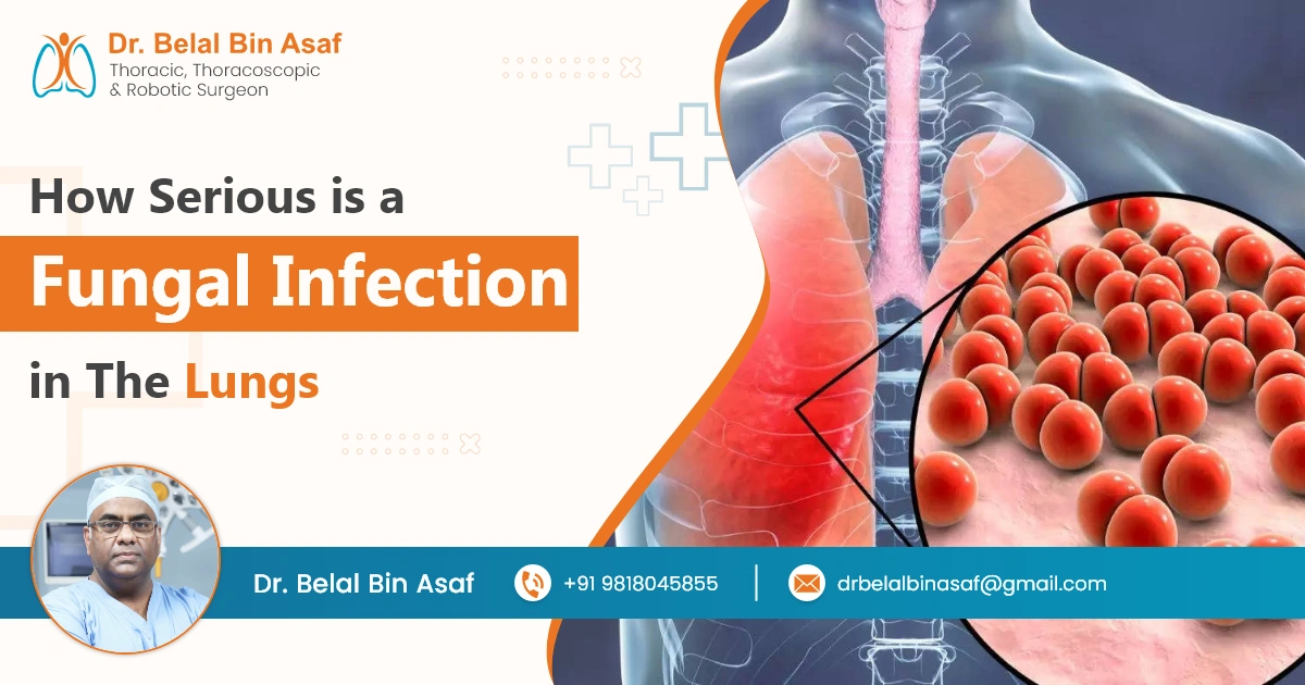 How Serious is a Fungal Infection in The Lungs