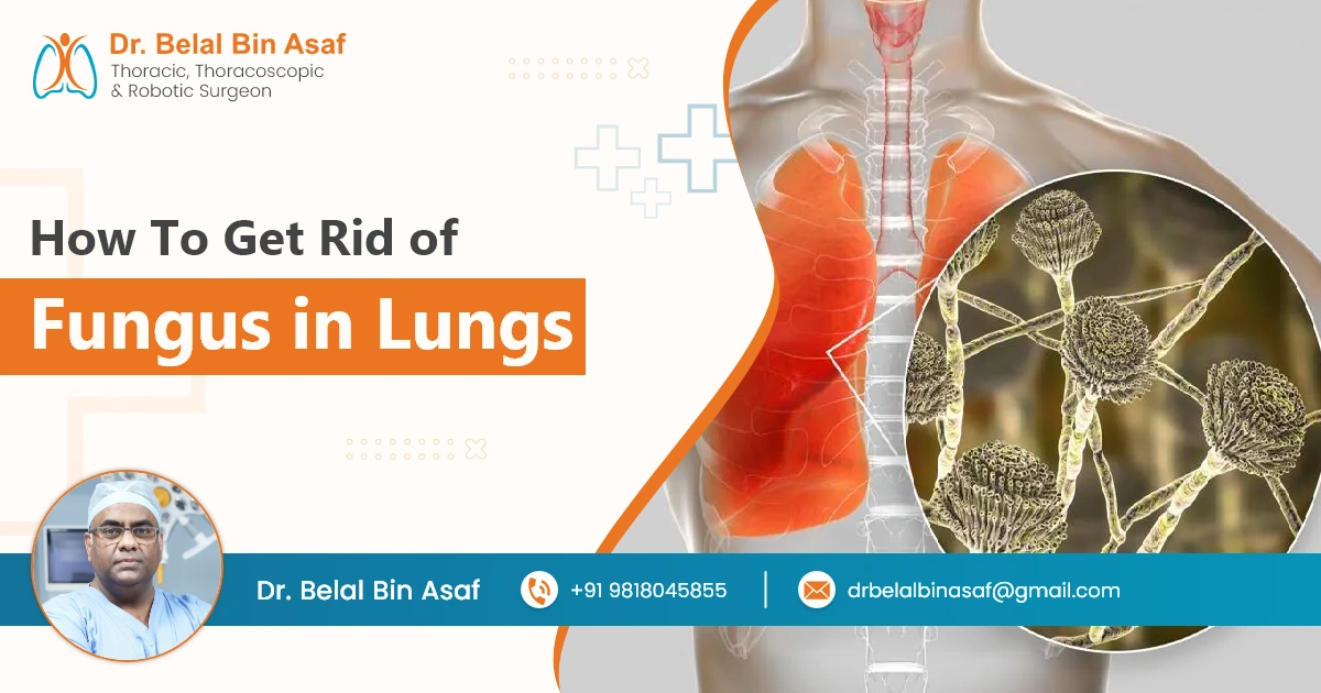 How to Get Rid of Fungus in Lungs