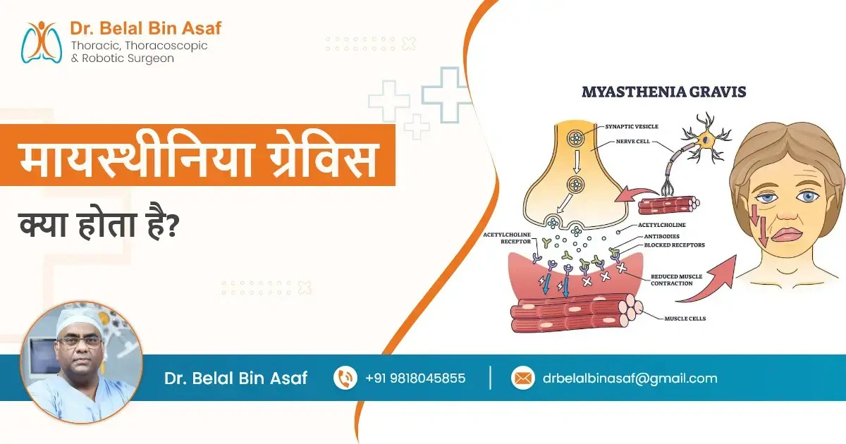 मायस्थीनिया ग्रेविस क्या होता है?