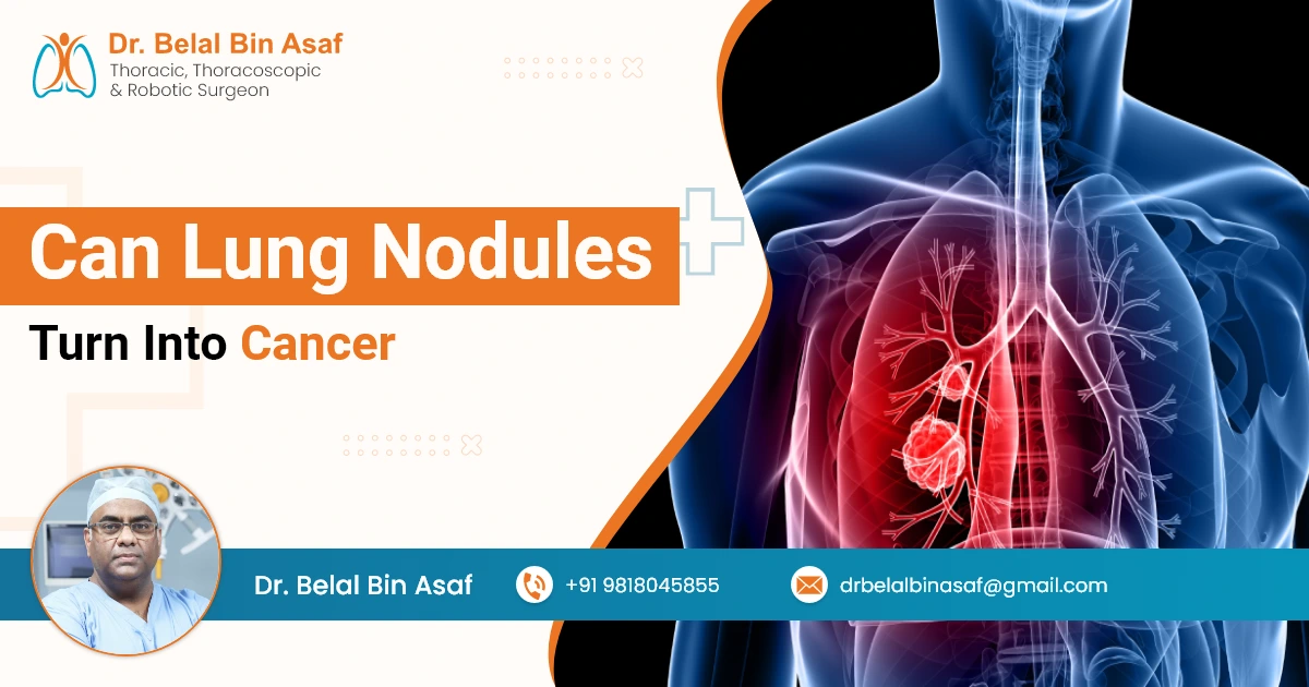 Can Lung Nodules Turn Into Cancer