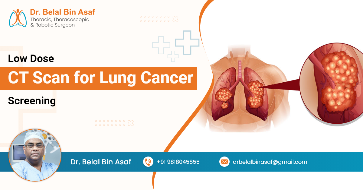 Low Dose CT Scan for Lung Cancer Screening